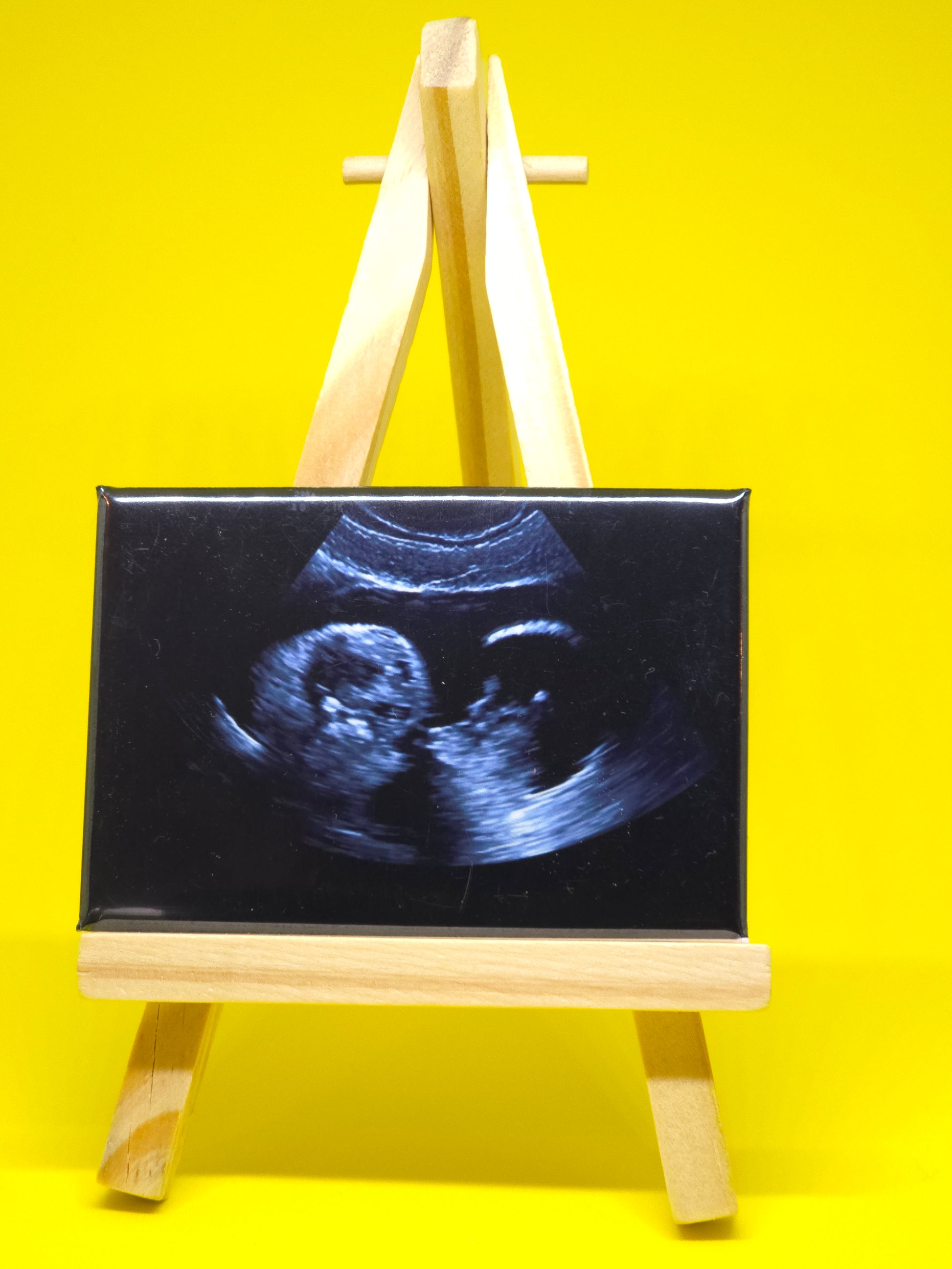 Ultrasound image in a wooden frame on a yellow background