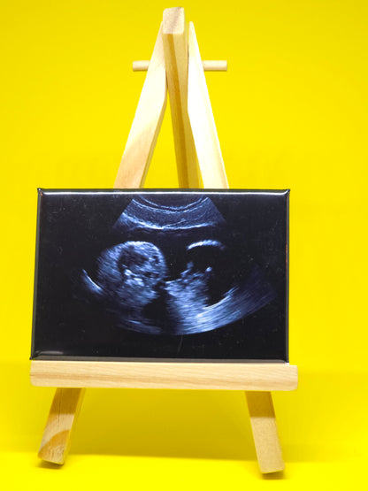 Ultrasound image in a wooden frame on a yellow background